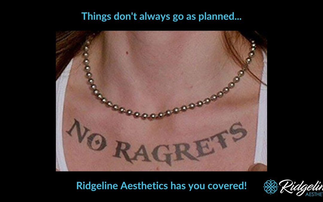 Tired of Your Tattoos?